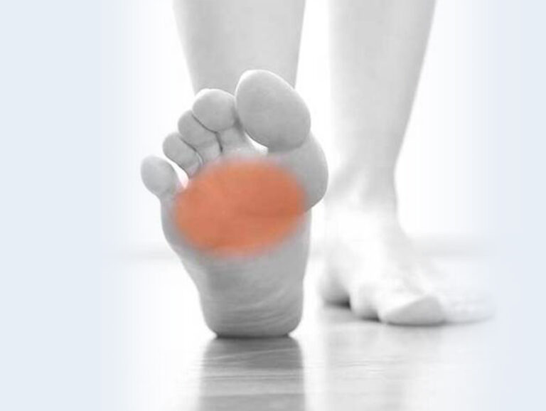 Ball of Foot Pain Metatarsalgia Insoles Metatarsal Orthotics