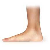 Flat Foot22