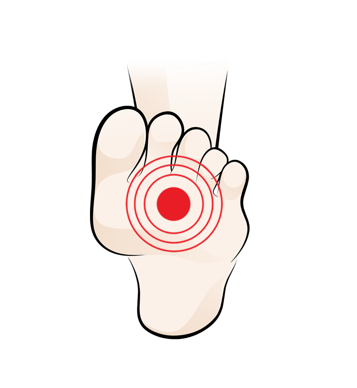 Ball Of Foot Pain