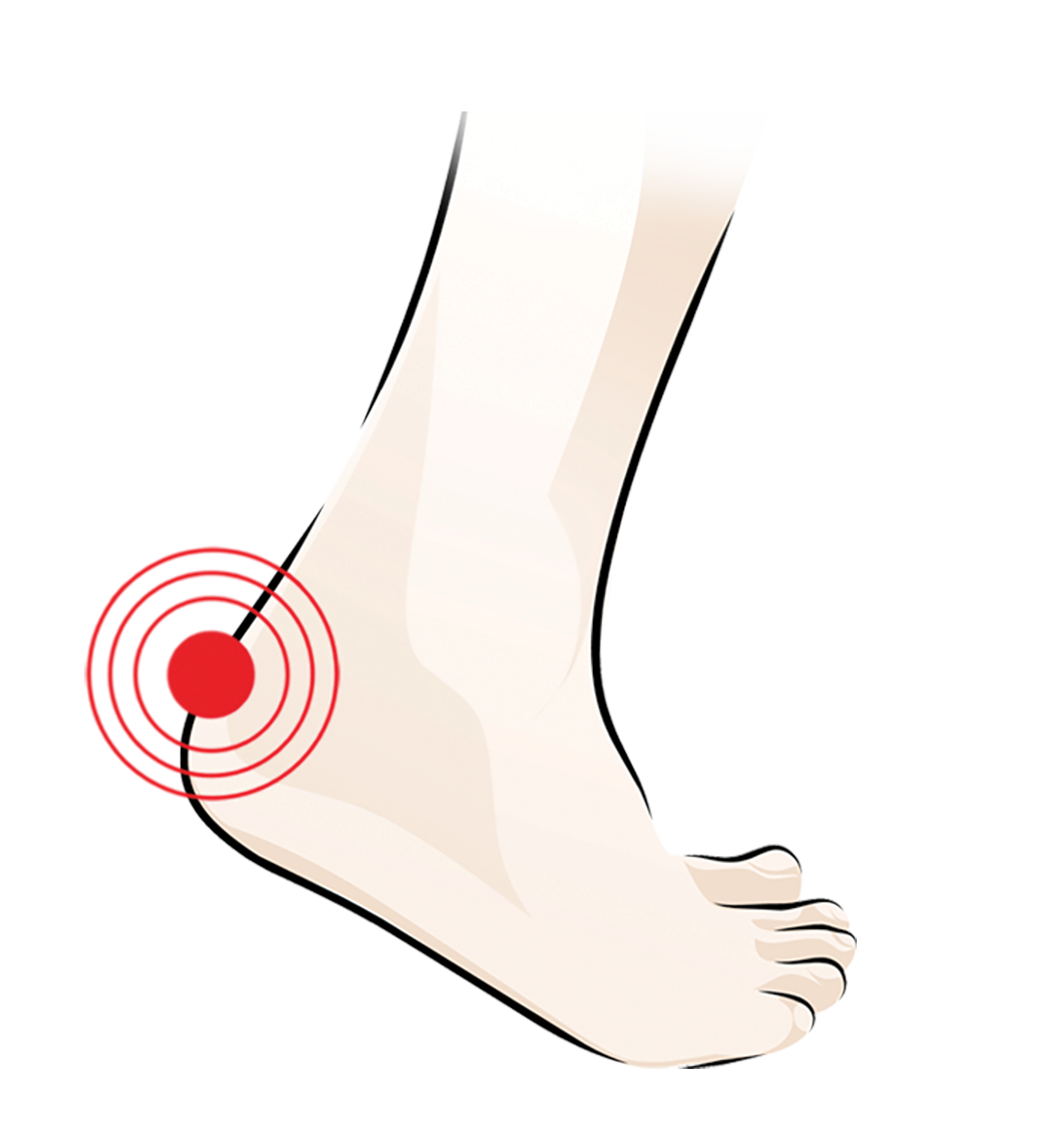 Illustration of a human foot with a red target symbol highlighting pain or discomfort at the heel area.