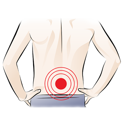 Illustration of a person’s lower back with a red target symbol indicating pain or discomfort in the lumbar area.