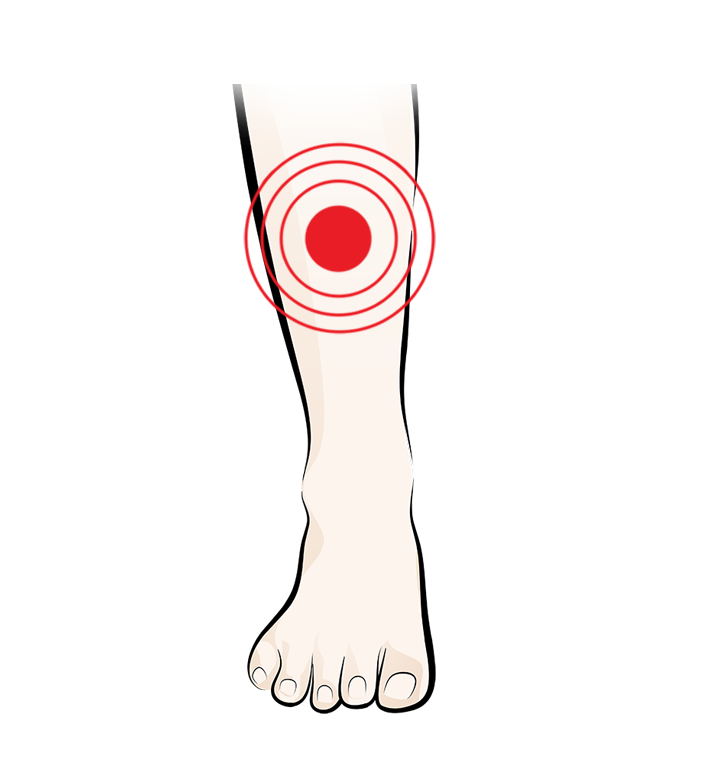 Illustration of a lower leg and foot with a red target symbol indicating pain or injury on the shin area.