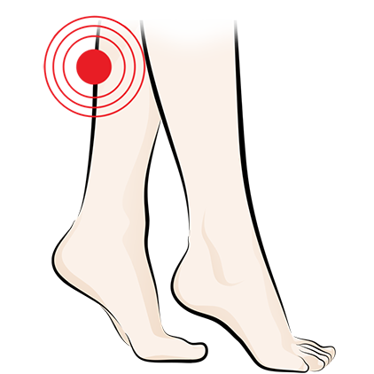 Illustration of two lower legs with a red target symbol over the calf area, indicating pain or discomfort.
