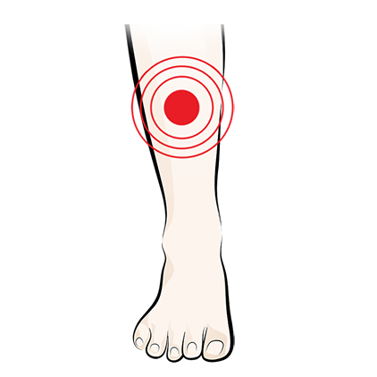 Illustration of a lower leg and foot with a red target symbol indicating pain or discomfort in the shin area.