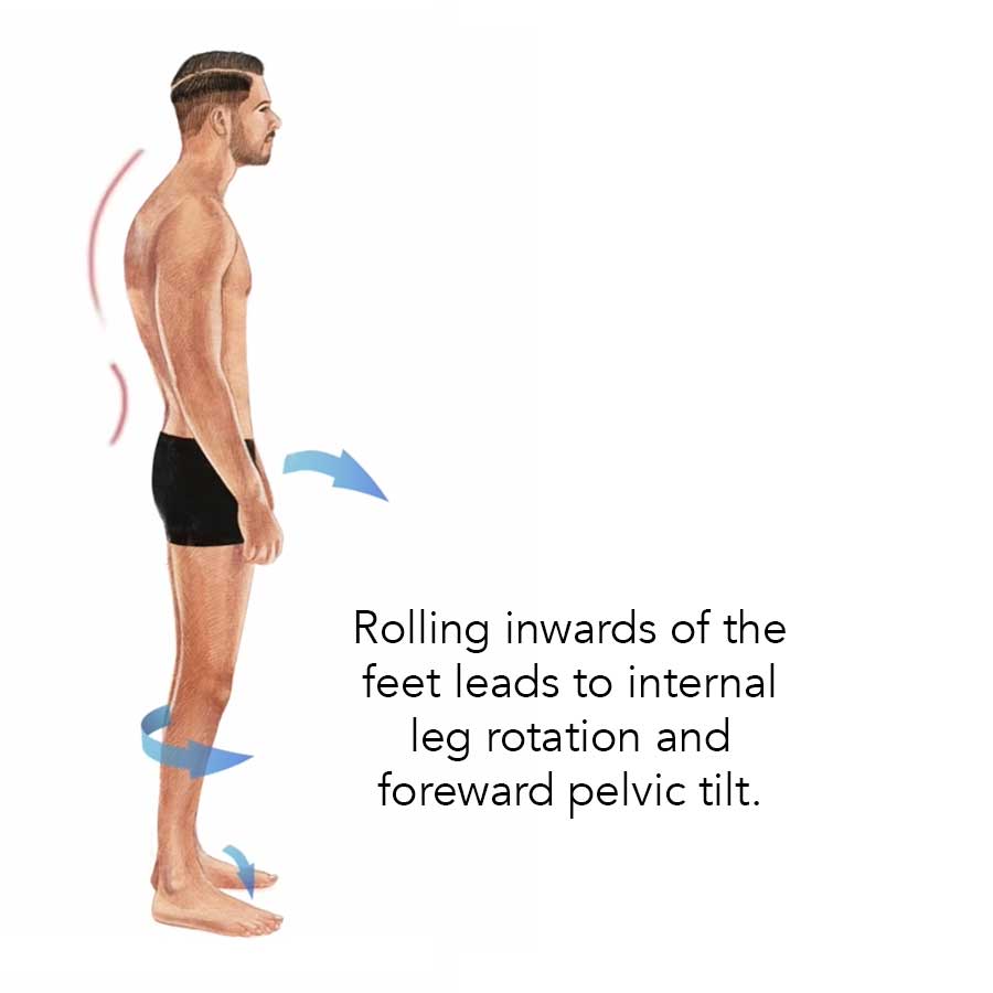 Side view illustration of a man showing inward foot rolling, internal leg rotation, and forward pelvic tilt, with arrows indicating the directions and explanatory text.