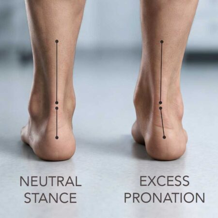 over-pronation and soccer