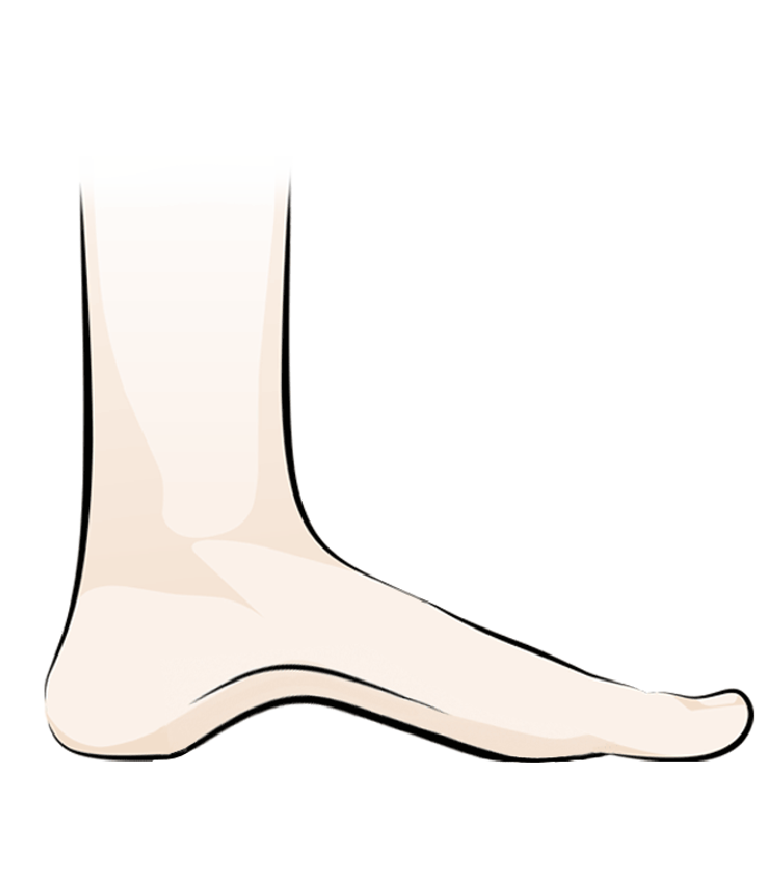insoles for high arches
