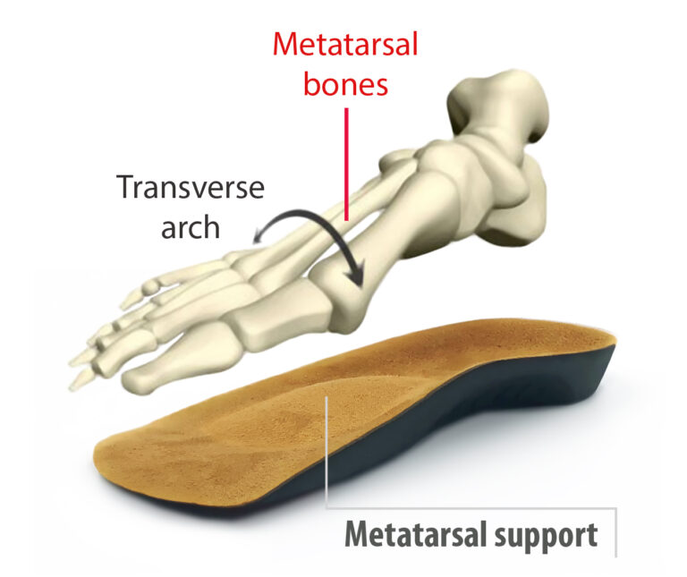 metatarsal bones