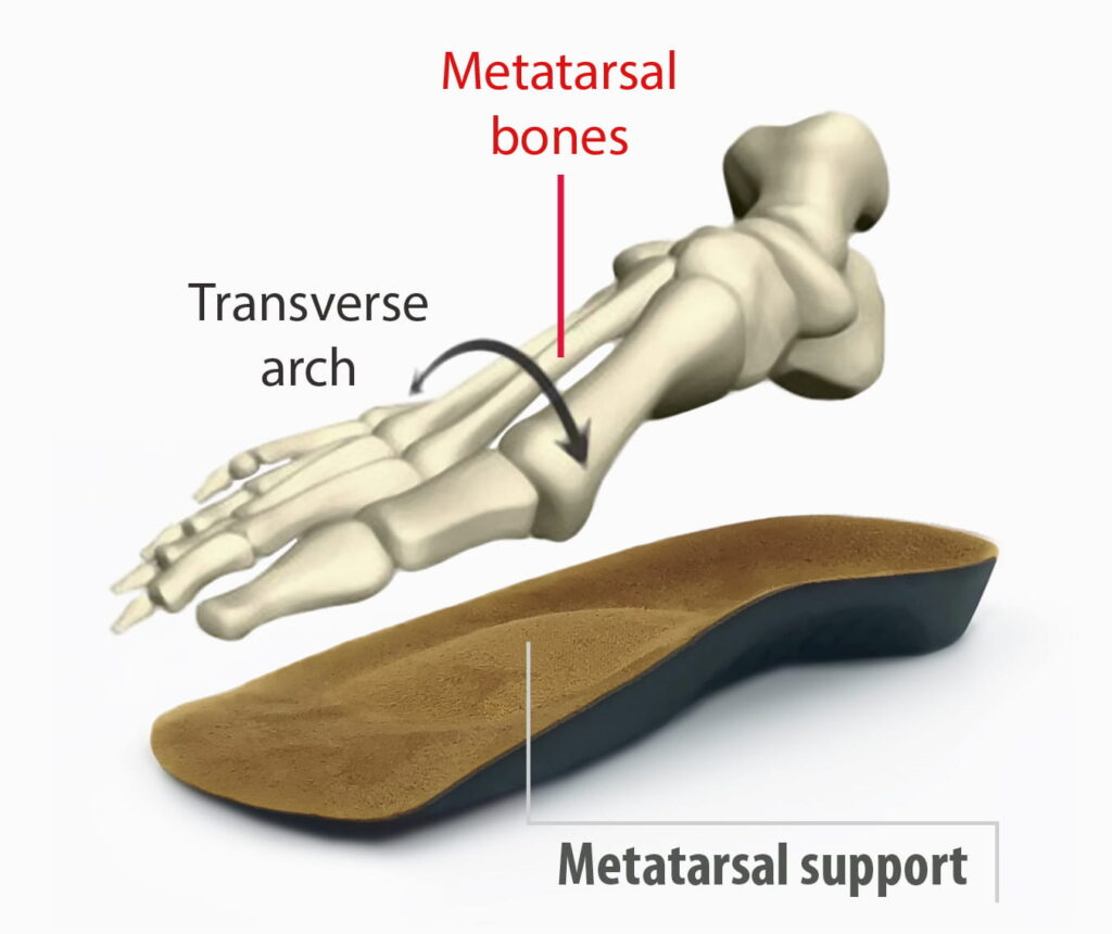 Meta Bone Support