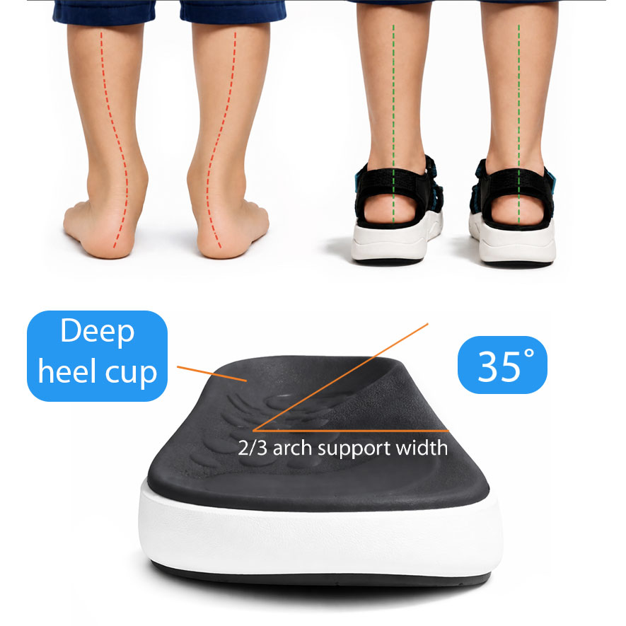 Two children's legs, one with flat feet and one with normal arches, above a close-up of a shoe insert showing a deep heel cup, 35° angle, and 2/3 arch support width.